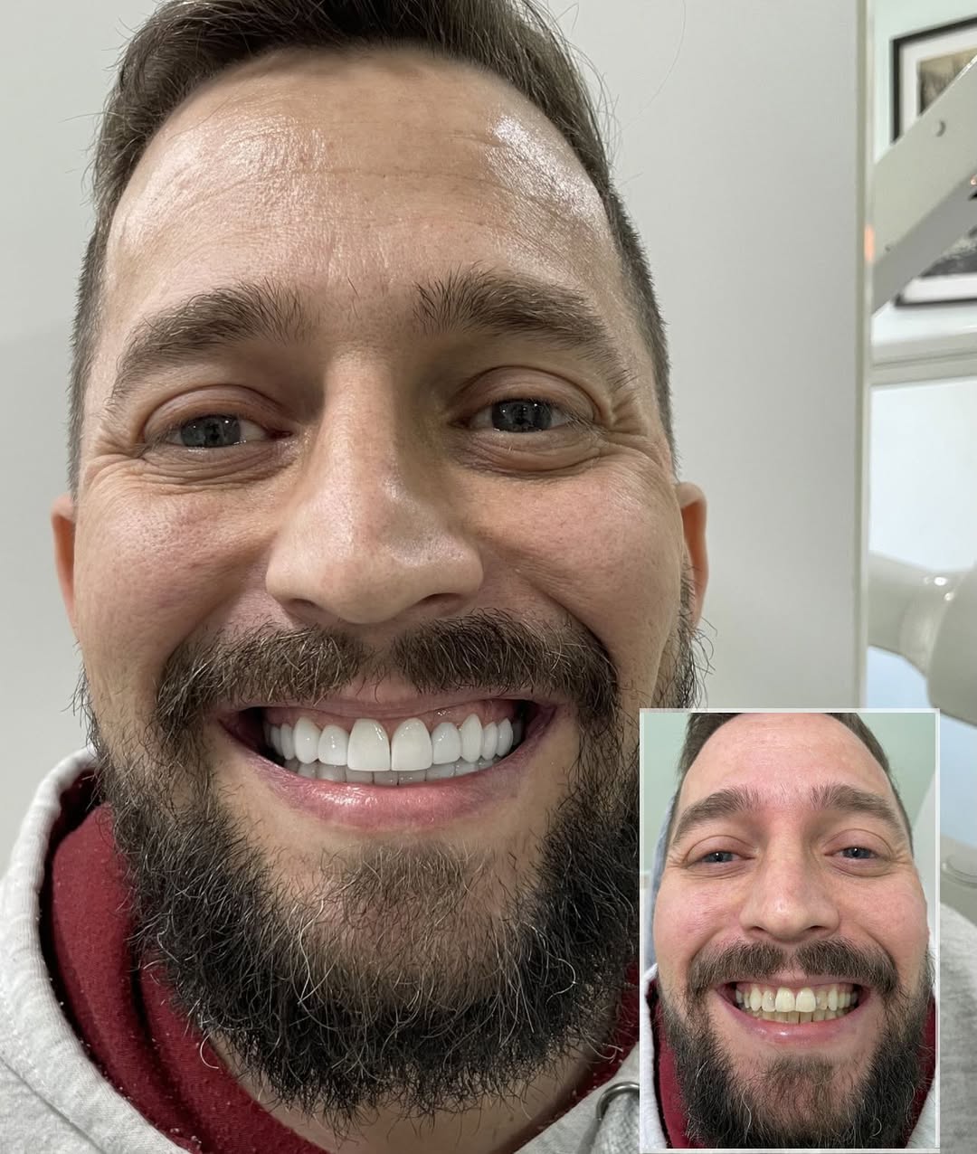 Sorriso Renovado — antes e depois